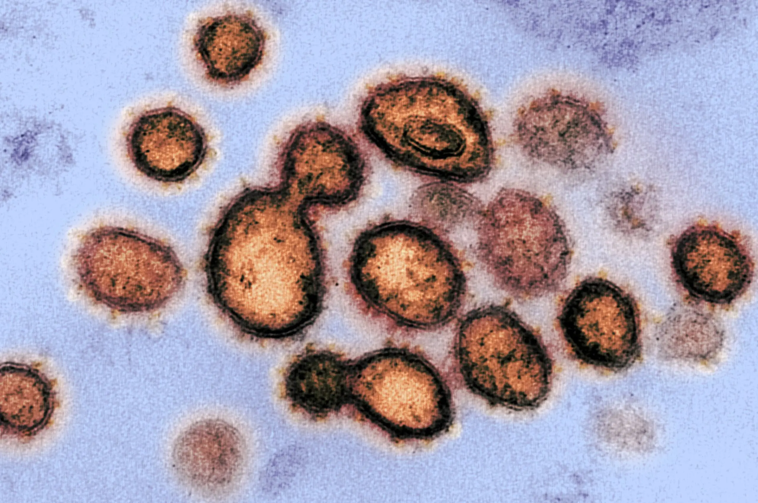 covid 19 sars cov 2 microscrope